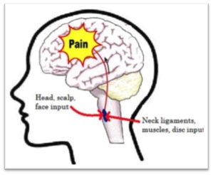 Headaches, Migraines and Pilates